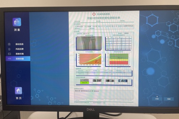 骨密度低怎么辦?養成良好生活習慣,從多方面增強骨密度 骨密度低怎么辦?養成良好生活習慣,從多方面增強骨密度
